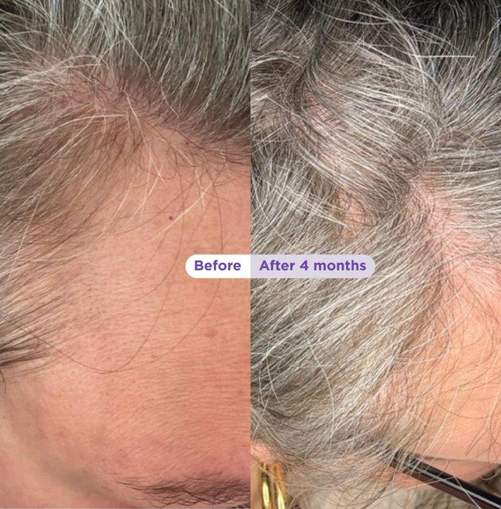 Before and After Results